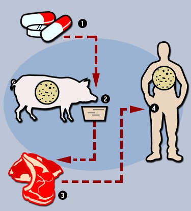 Super-Bugs, Factory Farming and the End of Antibiotics